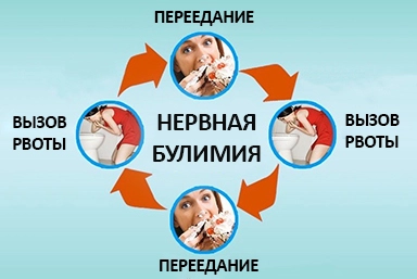 Лечение булимии в Ногире